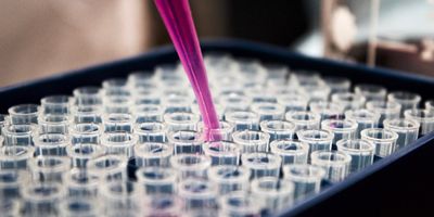 Wie schnell alterst du? Epigenetische Tests erklärt